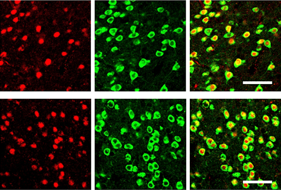 Confocal image of tagged medium spiny neurons in red and green