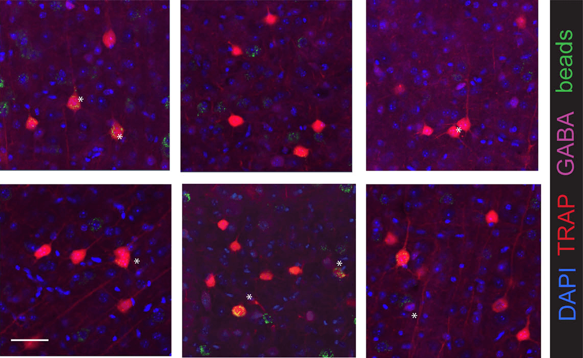 Confocal image of stress-tagged prefrontal neurons that project to the nucleus accumbens, in red on blue
